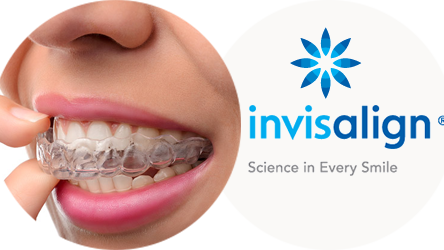medium_Top-10-Tips-about-your-invisalign-aligners
